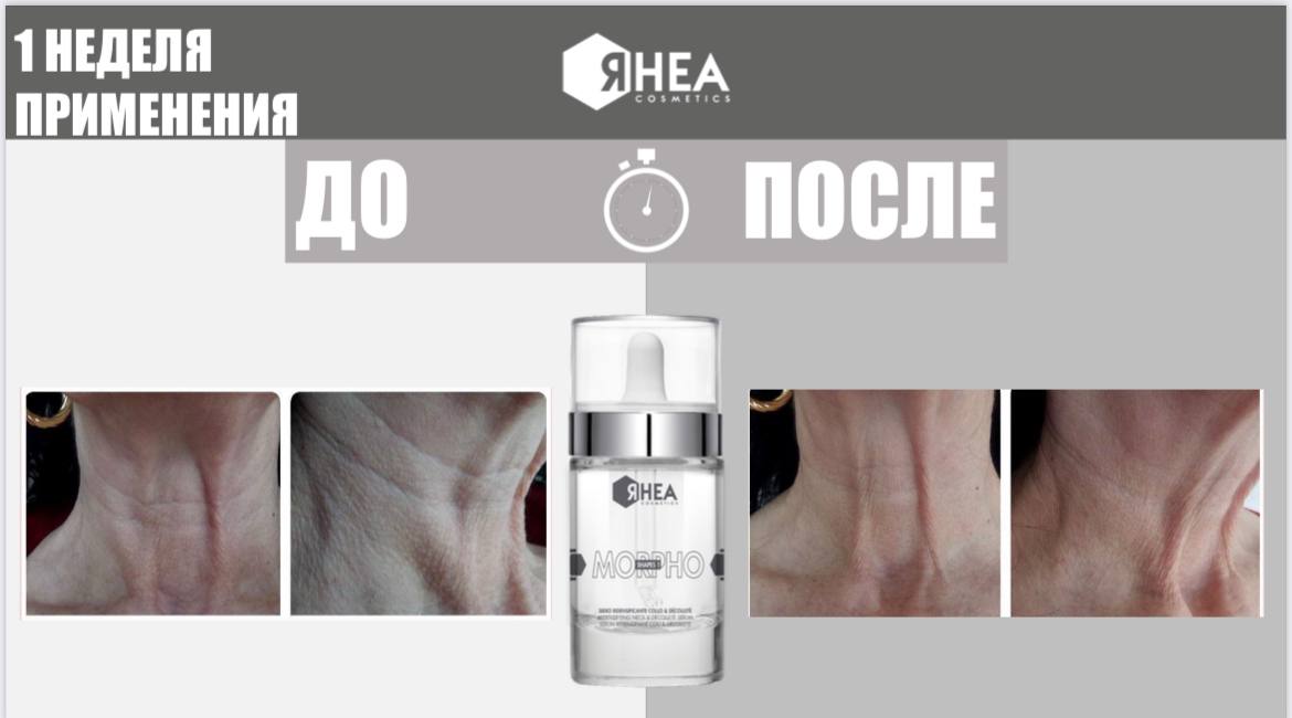 Rhea Cosmetics Ремоделирующий серум для кожи шеи и декольте Morphoshapes 1 Redensifying Neck And Décolleté Serum