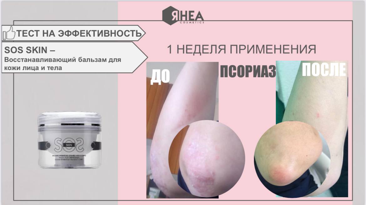 Rhea Cosmetics Восстанавливающий бальзам для кожи лица и тела SOS Skin Face Body Repair Balm