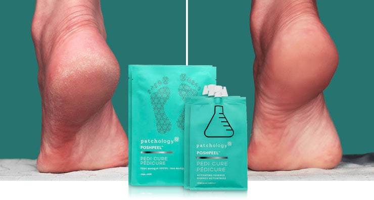 Patchology Отшелушивающий пилинг для ног Poshpeel pedi cure